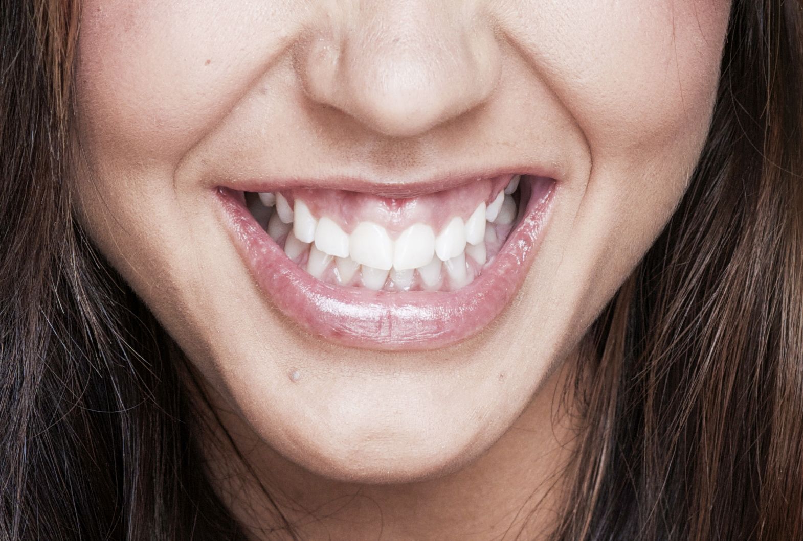 The Aesthetic Appeal of Gum Sculpting: Procedure and Benefits