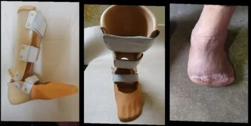 Foldable Mobility Scooter