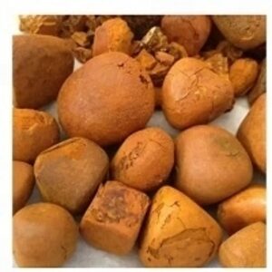 Gallstones by Loui Fabs Ltd