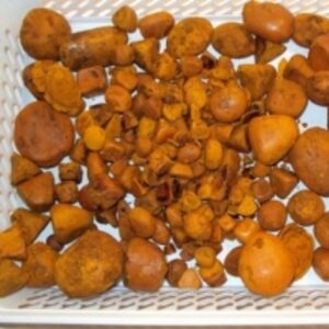  Gallstones For Sale 