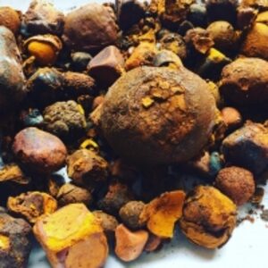  Top Quality Gallstones 