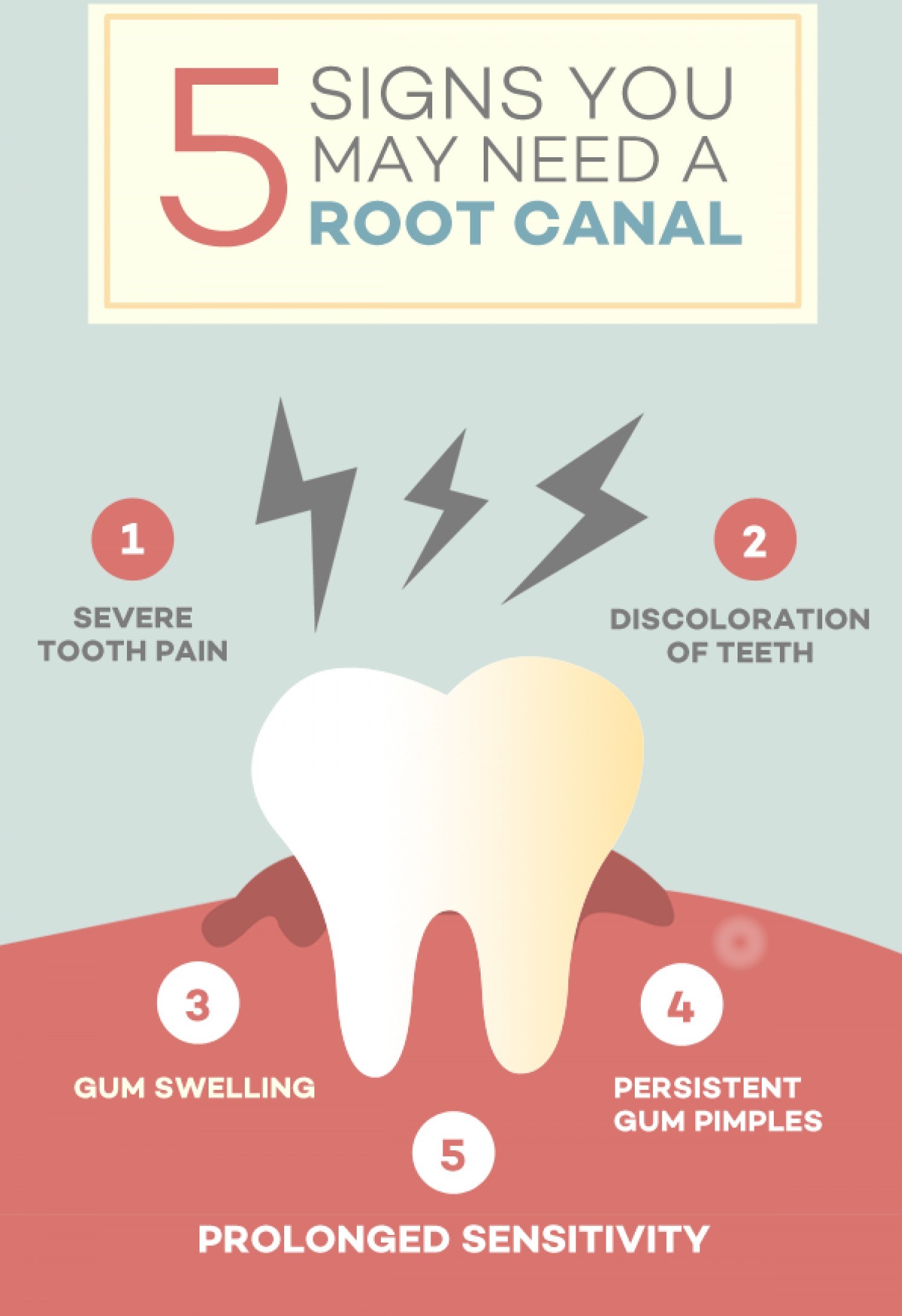 Common Symptoms and Signs You Might Need a Root Canal